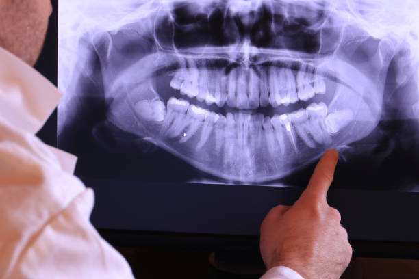 Best Emergency Root Canal Treatment in Hawthorne, NV