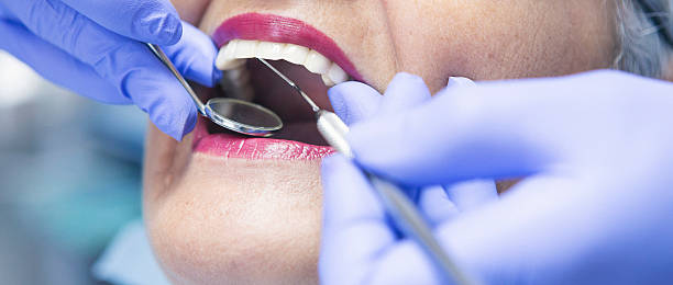 Best Emergency Tooth Extraction in Hawthorne, NV