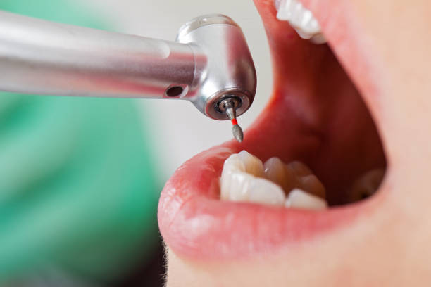 Best Emergency Dental Surgery in Hawthorne, NV